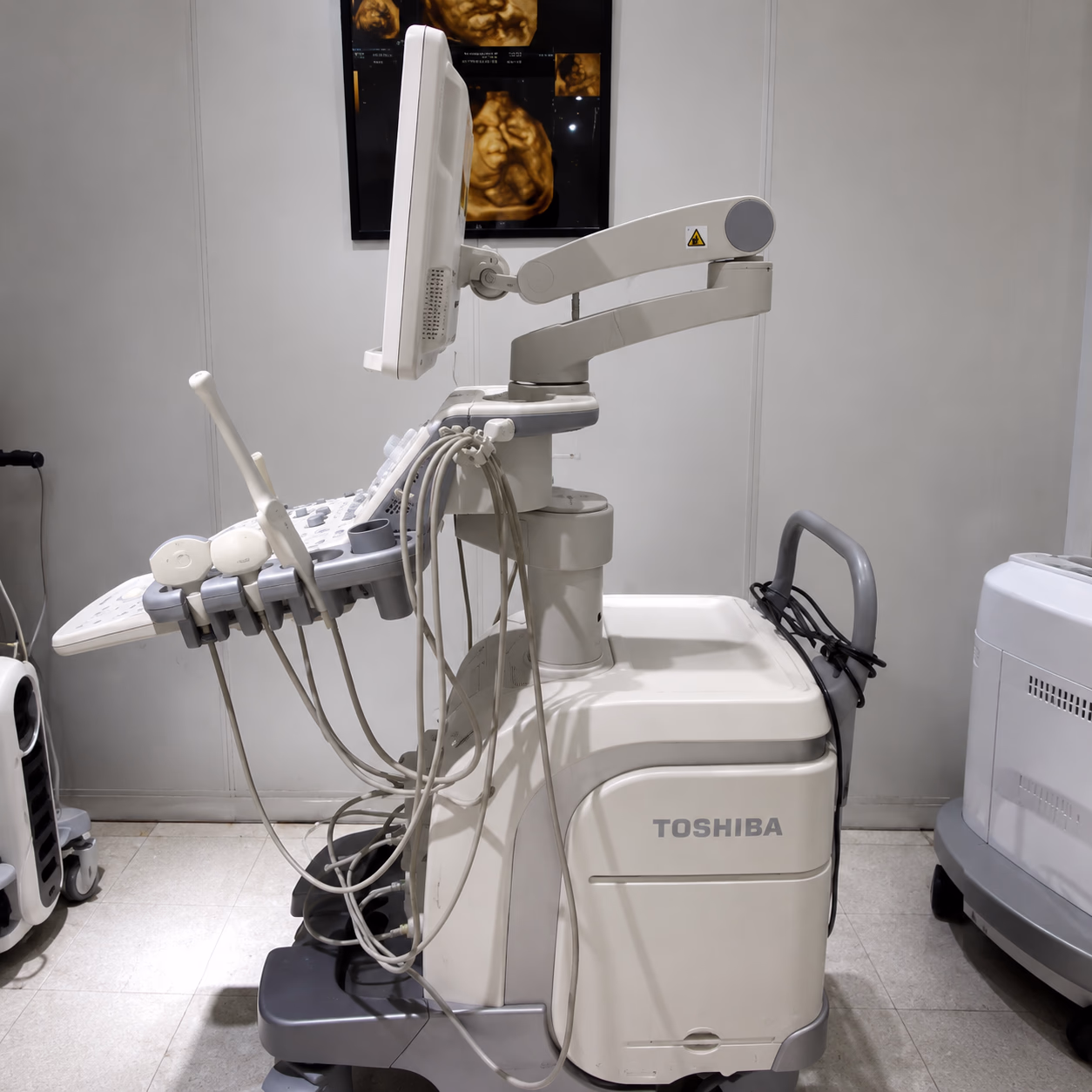 УЗД Canon (Toshiba) Aplio 500 — 3