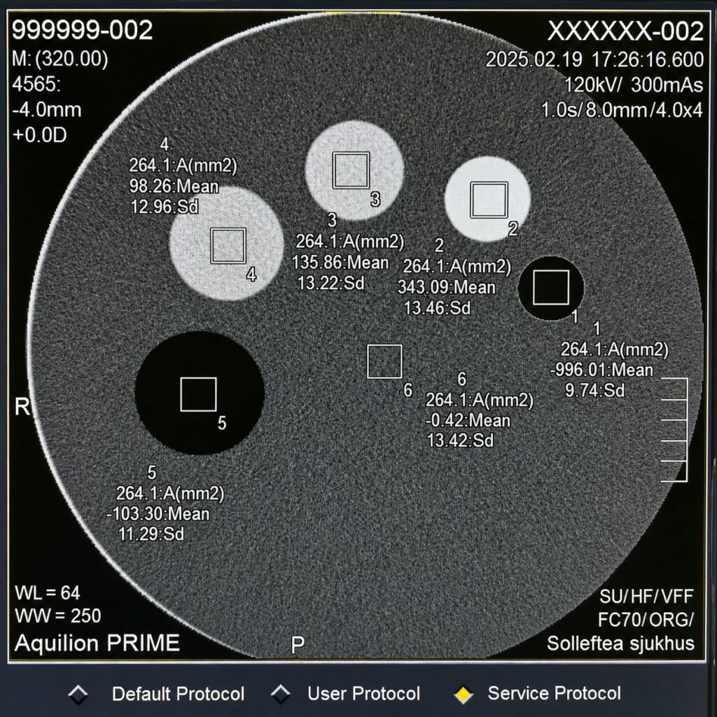 КТ Toshiba / Canon Aquilion Prime 160 зрізів — 3