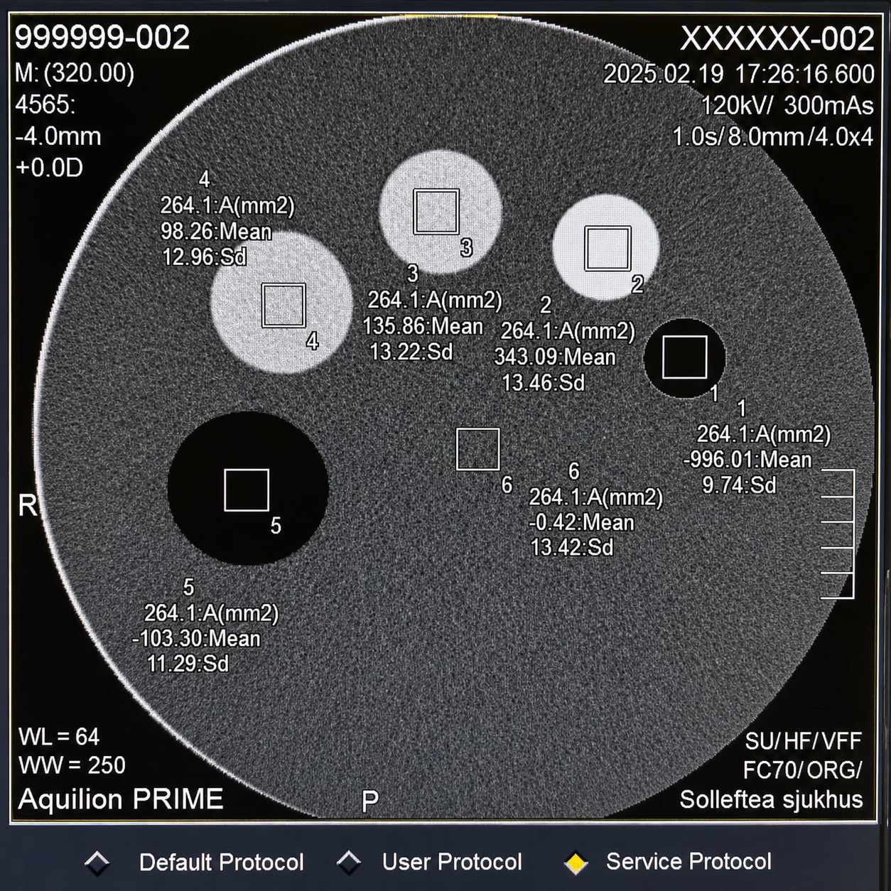 КТ Toshiba / Canon Aquilion Prime 160 зрізів — 3