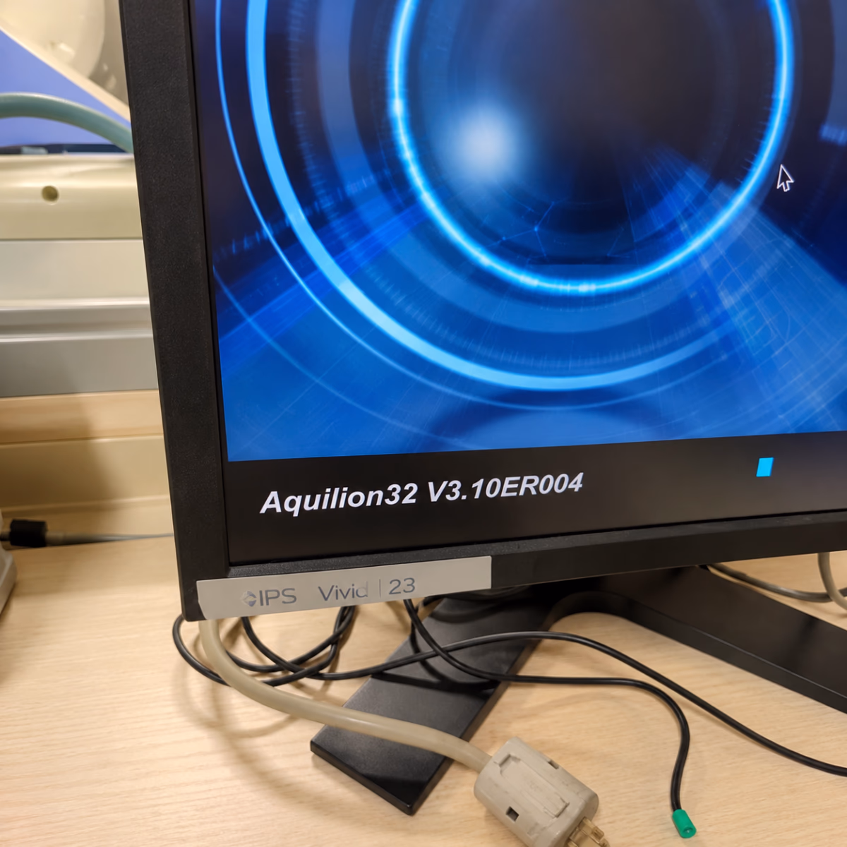 КТ Toshiba Aquilion 32 зрізи — 3