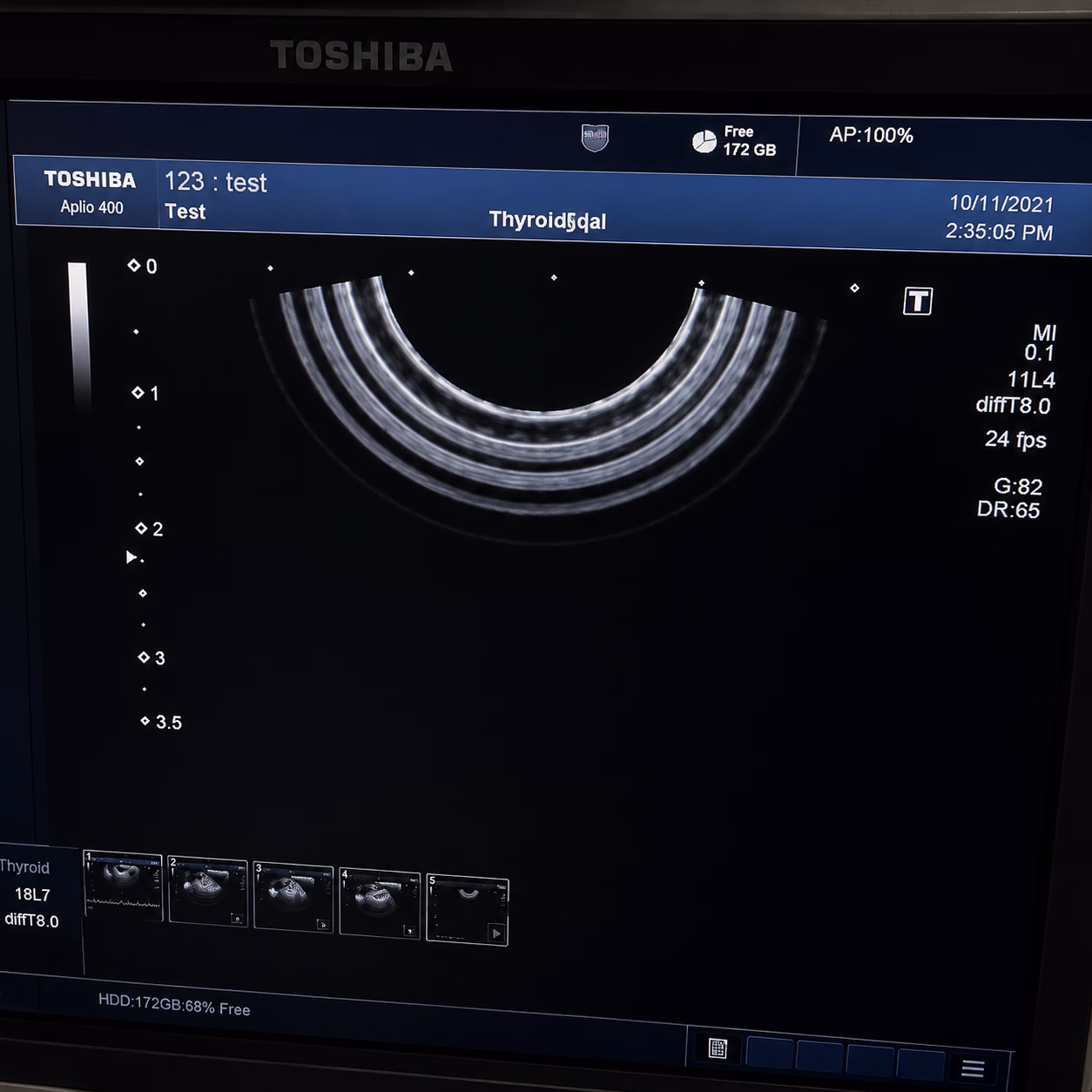 УЗД Canon (Toshiba) Aplio 500 — 9
